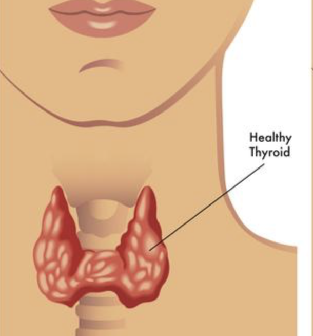 treating-high-thyroid-antibodies